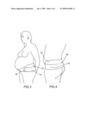 Lower uterine segment maternity support belt diagram and image