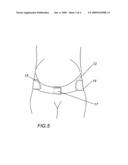 Lower uterine segment maternity support belt diagram and image