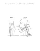 Lower uterine segment maternity support belt diagram and image