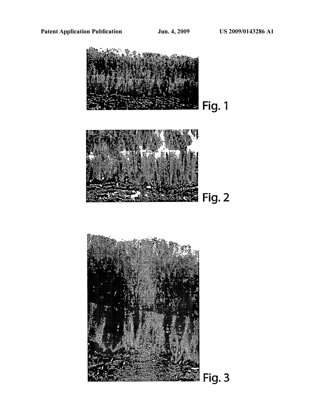Methods and Compositions for Regenerating Articular Cartilage - diagram, schematic, and image 02
