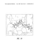 Protein Kinase Inhibitors diagram and image