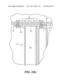 Transluminal endoscopic surgery kit diagram and image