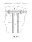 Transluminal endoscopic surgery kit diagram and image