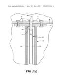 Transluminal endoscopic surgery kit diagram and image