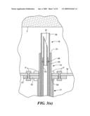 Transluminal endoscopic surgery kit diagram and image