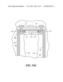 Transluminal endoscopic surgery kit diagram and image