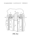 Transluminal endoscopic surgery kit diagram and image