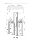 Transluminal endoscopic surgery kit diagram and image