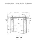 Transluminal endoscopic surgery kit diagram and image