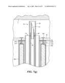 Transluminal endoscopic surgery kit diagram and image