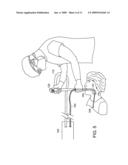 Catheter guided endotracheal intubation diagram and image