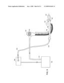 Catheter guided endotracheal intubation diagram and image