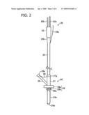 ENDOSCOPE SYSTEM FOR GASTROSTOMY CATHETER PLACEMENT diagram and image