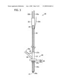 ENDOSCOPE SYSTEM FOR GASTROSTOMY CATHETER PLACEMENT diagram and image