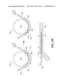 ANALYTE SENSOR diagram and image