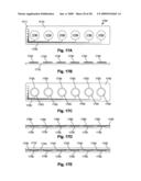 Pulmonary Monitoring System diagram and image