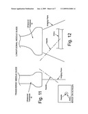 NEEDLE GUIDE SYSTEM FOR USE WITH ULTRASOUND TRANSDUCERS TO EFFECT SHALLOW PATH NEEDLE ENTRY AND METHOD OF USE diagram and image