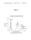 Method and Apparatus for Detecting Diseases Associated with the Eye diagram and image