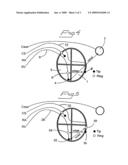 Detection of ischemia diagram and image