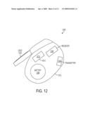 Physiologic Signal Processing To Determine A Cardiac Condition diagram and image