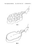 MODIFICATION OF AIRWAYS BY APPLICATION OF ULTRASOUND ENERGY diagram and image