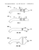 MODIFICATION OF AIRWAYS BY APPLICATION OF ULTRASOUND ENERGY diagram and image