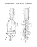 MODIFICATION OF AIRWAYS BY APPLICATION OF ULTRASOUND ENERGY diagram and image