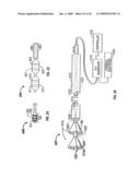 MODIFICATION OF AIRWAYS BY APPLICATION OF ULTRASOUND ENERGY diagram and image