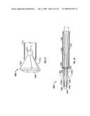 MODIFICATION OF AIRWAYS BY APPLICATION OF ULTRASOUND ENERGY diagram and image