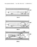 MODIFICATION OF AIRWAYS BY APPLICATION OF ULTRASOUND ENERGY diagram and image