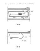 MODIFICATION OF AIRWAYS BY APPLICATION OF ULTRASOUND ENERGY diagram and image