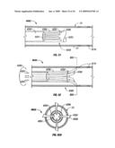 MODIFICATION OF AIRWAYS BY APPLICATION OF ULTRASOUND ENERGY diagram and image