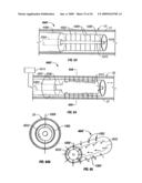 MODIFICATION OF AIRWAYS BY APPLICATION OF ULTRASOUND ENERGY diagram and image