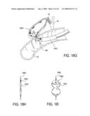Biliary Shunts, Delivery Systems, Methods of Using the Same and Kits Therefor diagram and image