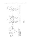 Navigation method and system for drilling operation in spinal surgery diagram and image