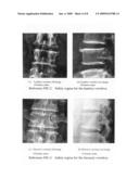 Navigation method and system for drilling operation in spinal surgery diagram and image