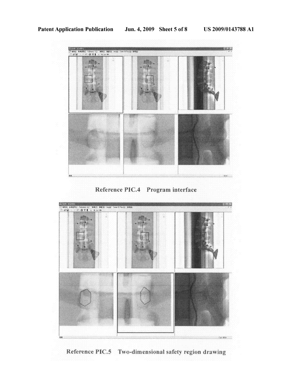 Navigation method and system for drilling operation in spinal surgery - diagram, schematic, and image 06