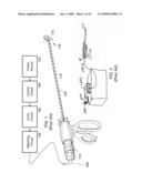 Cordless Hand-Held Ultrasonic Cautery Cutting Device diagram and image