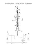 Cordless Hand-Held Ultrasonic Cautery Cutting Device diagram and image