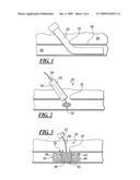 Apparatus and Method for Sealing a Vessel Puncture Opening diagram and image