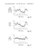 Baroreflex modulation to gradually decrease blood pressure diagram and image