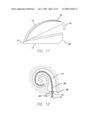 Cochlear Stimulation Device diagram and image