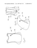 VACUUM STABILIZED CARRY BAG diagram and image