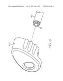 Lead screw locking device diagram and image