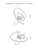 Lead screw locking device diagram and image