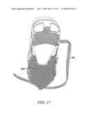 ELECTROSTATIC DISCHARGING OVERSHOE diagram and image