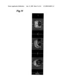 Image Processing Method, Image Processing Program, and Image Processing Device diagram and image