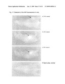 FUNCTIONALIZED, SOLID POLYMER NANOPARTICLES COMPRISING EPOTHILONES diagram and image