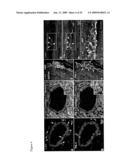 COMPOSITIONS COMPRISING VASCULAR AND MYOCYTE PROGENITOR CELLS AND METHODS OF THEIR USE diagram and image