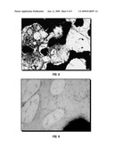 Antibiotic Microspheres for Treatment and Prevention Of Osteomyelitis and Enhancement of Bone Regrowth diagram and image